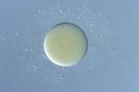 Fécondation externe chez l'Oursin (spermatozoïdes et ovule) x100